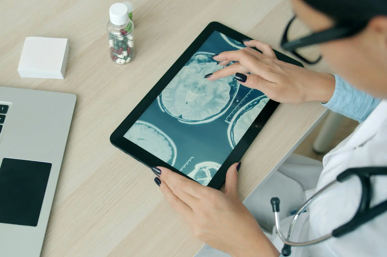 Beyaz önlüklü hekim, tablet ekranındaki beyin kesitlerini inceliyor.